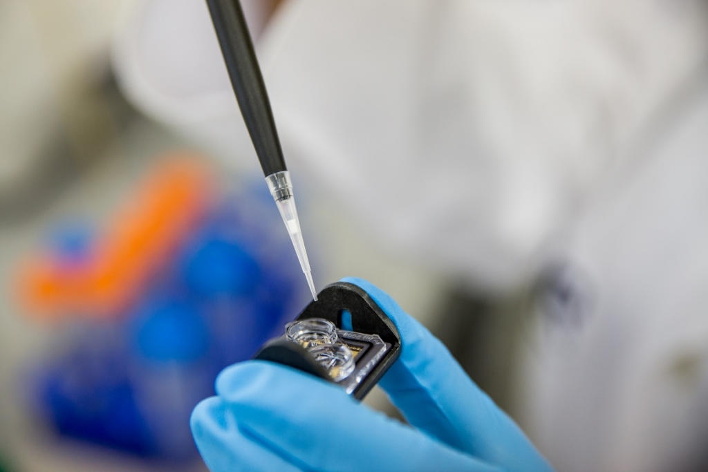 Hand holding a container with yellowish liquid